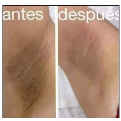 Crema Aclaradora Para Piel En Cara, axilas, entrepierna... luce hermosa !!! ¡¡¡PAGA AL RECIBIR!!!