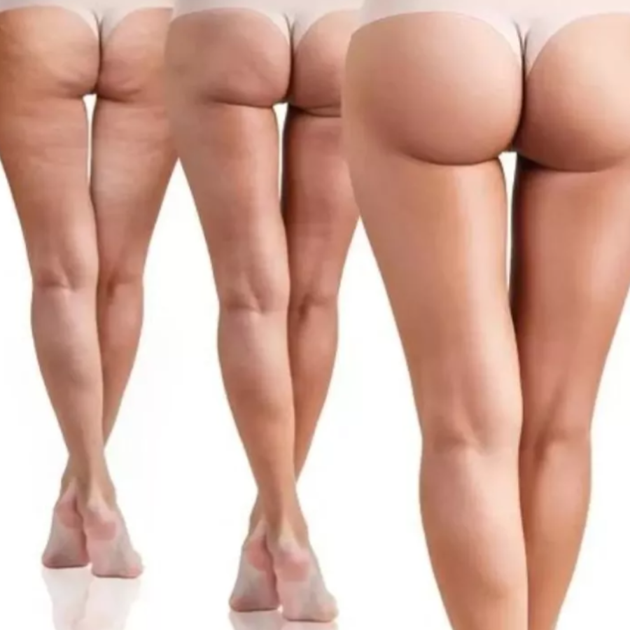 Gel crema Levanta Aumenta Gluteos, luce esos gluteos espectaculares ¡¡¡PAGA AL RECIBIR!!!